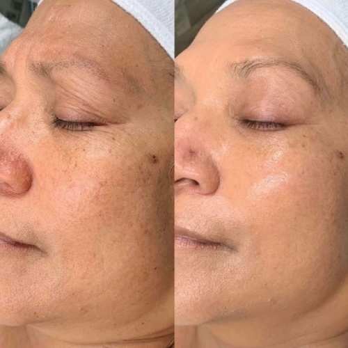 a before and after shot of a woman's face